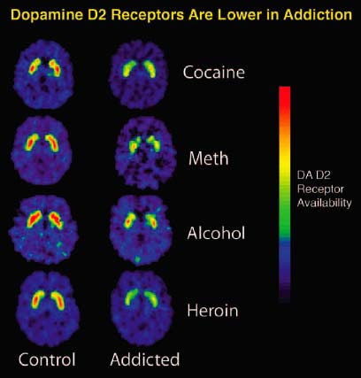 receptors-in-addiction